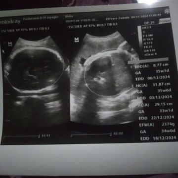 Ada yang ngalamin gak Bun?