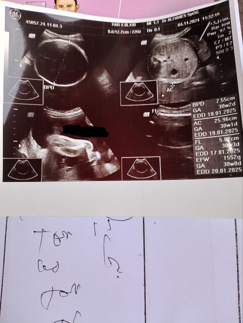 Assalamualaikum bumil🥰 ada yg sama hpl 20 Januari JK nya apa di tahun depan 😁 sehat selalu semua❤️