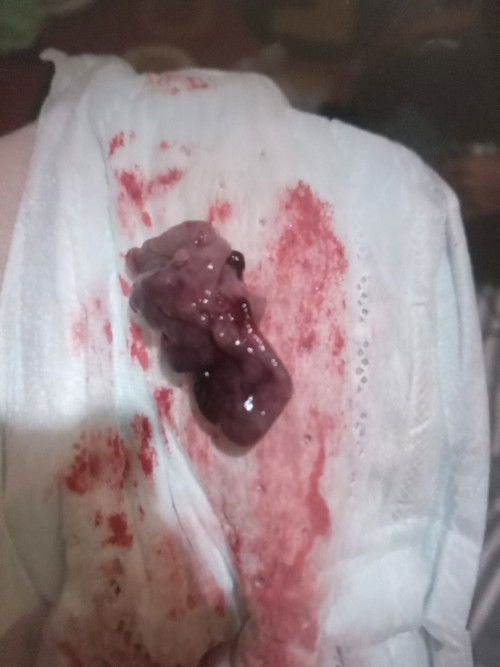 Apakah aku keguguran ?