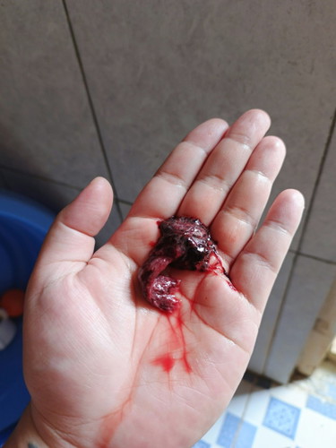 ini apa ya?