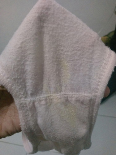 Bun maap jorok , keputihan ku keluar warna kaya gini tp gk gatal dan bau solusi nya dong tm 1