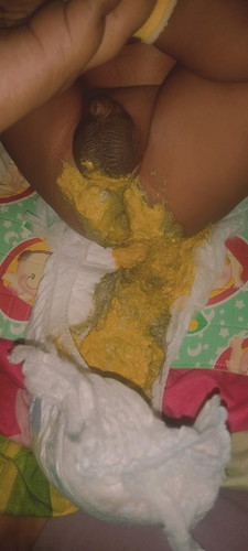 Ada yang pernah ngalamin gak??bayi umur 2bulan tiba² pup warnanya gini??