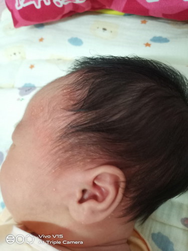 น้องได้2อาทิตย์
