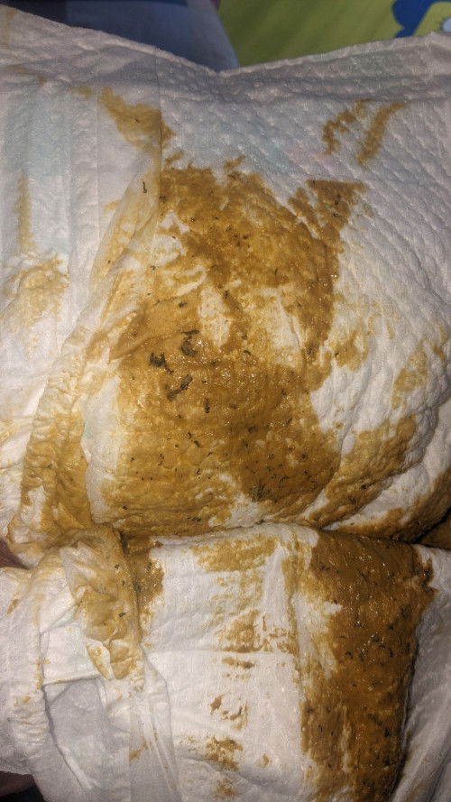 Ano po kaya yung black sa poopoo ni baby ? Kahapon sinubuan ko sya ng banana pero konti lang naman!