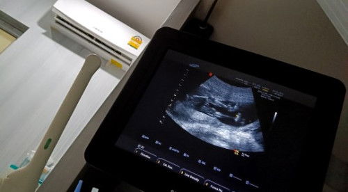 ดูเพศจากอัลตร้าซาวด์