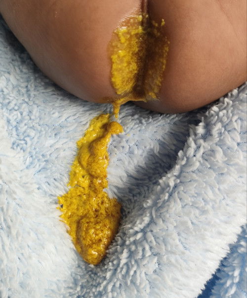 ขออนุญาติและขออภัยสำหรับรูปภาพนะคะ