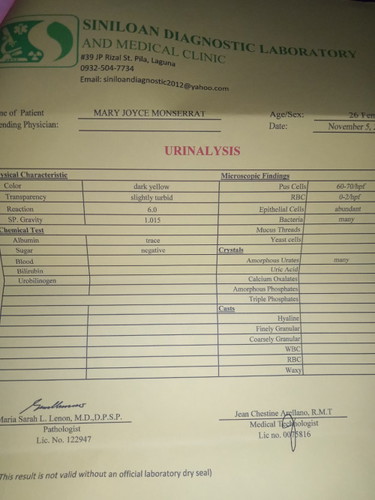 Hi mga hi may tatanong lang