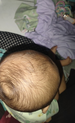 Rambut bayi 8 bln blm numbuh2
