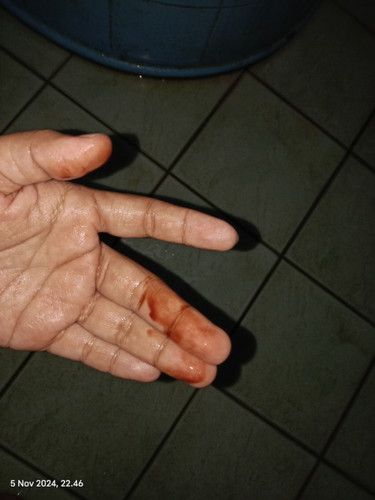 Flek Darah Tapi Kok Kaya Coklat