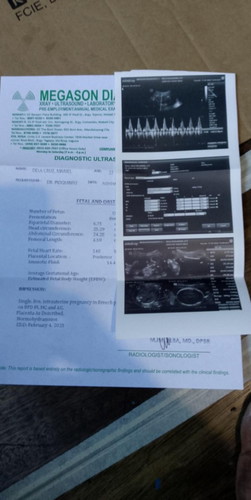 Panu po manormal c baby suwi PO Kase sya