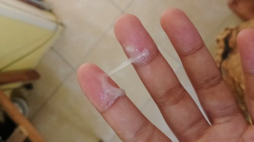 Keluar lendir kental usia kehamilan 35 minggu