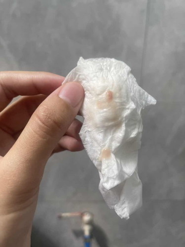 38+3 เมื่อวานมีมูกเลือดสีชมพู ปวดท้องหน่อยๆเหมือนเป็นประจำเดือน