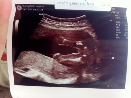 ผู้หญิงหรือผู้ชาย