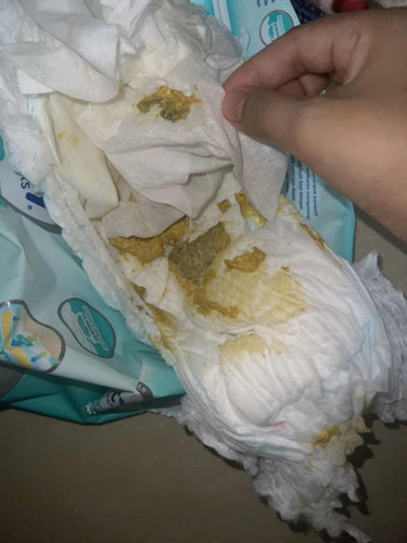 Apakah aman pup bayi sufor seperti ini ?