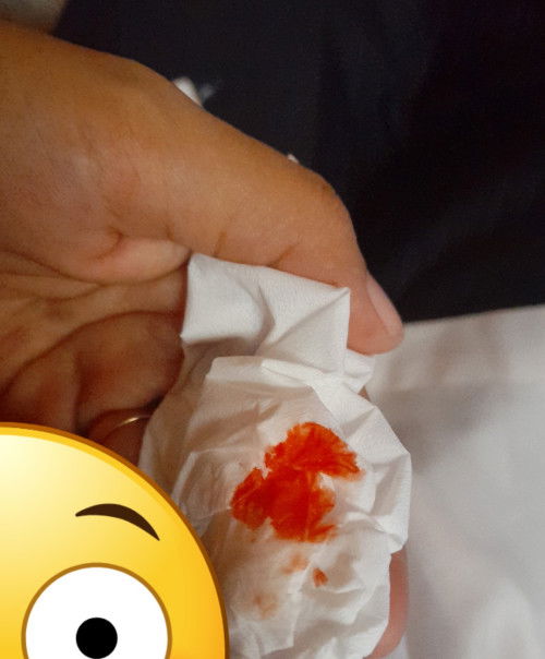 P#ting digigit sampe berdarah