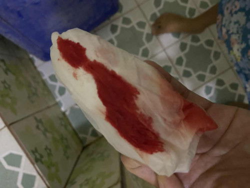 Keluar darah di usia 11 mgg