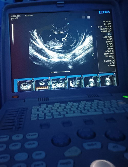 Ask lang po mga ka momshie baka may idea po kayo kung ano gender ni baby☺️🥰