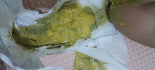 Yang jijik mohon di skip aja ( BAB BAYI 5 BULAN)