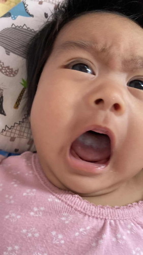 ลูกลิ้นขาวแบบนี้บ้านไหนเป็นเหมือนกันมั้ยคะ