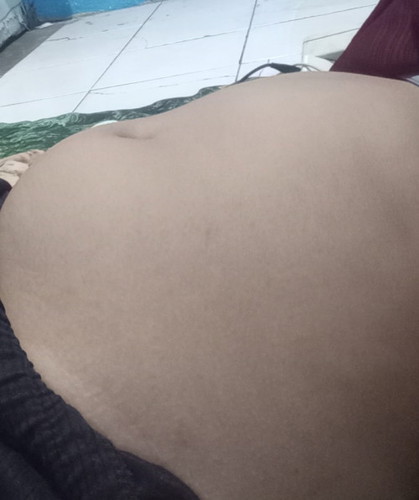 Kak saya mau tanya Usia kehamilan 17 minggu perut tidak bulat apakh normal atau tidak?