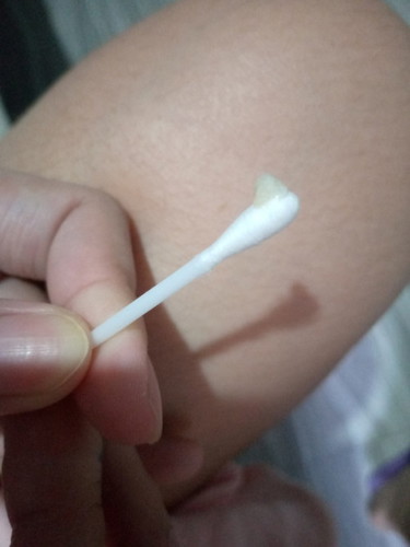 May sipon na po ba si baby ? nakuha ko ito