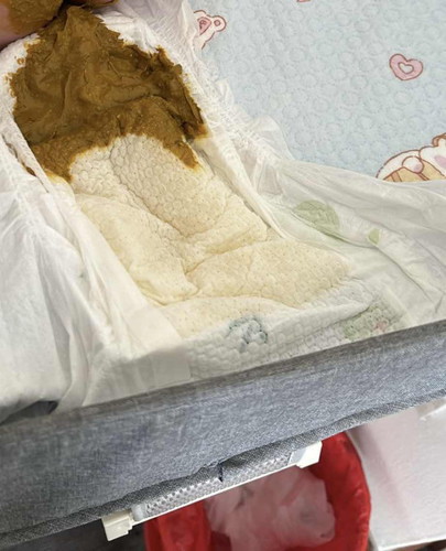 Baby’s Poo