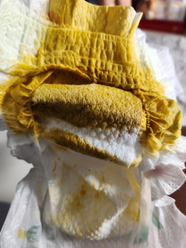 Diarrhea or normal?
