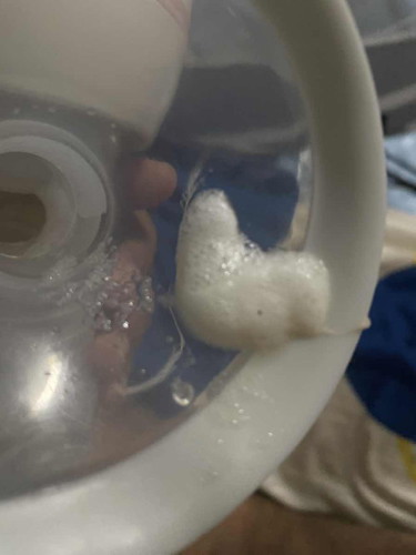 หัวนมแบบนี้เกิดจากอะไรหรอคะ