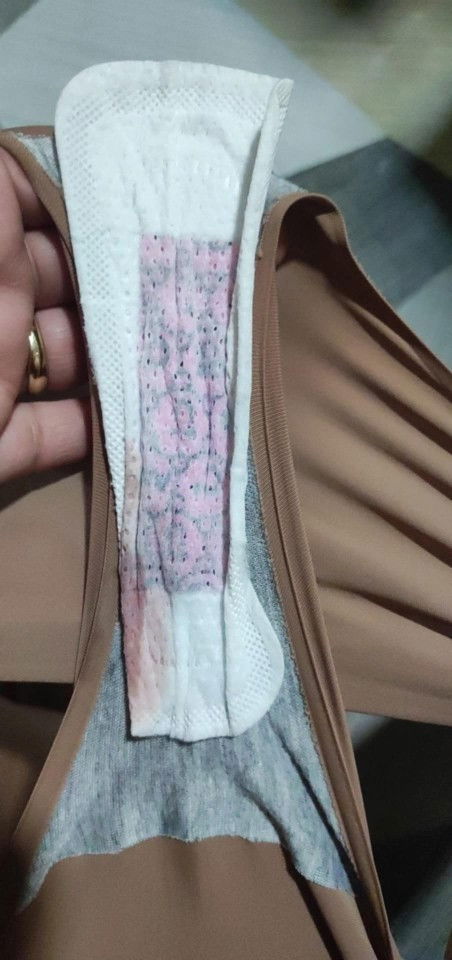 Nasa 6 weeks going 7 weeks po. Ano po kaya ito? Help naman po. Sino na pong nakaranas nito ?