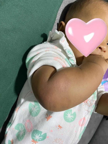Kulit baby kasar