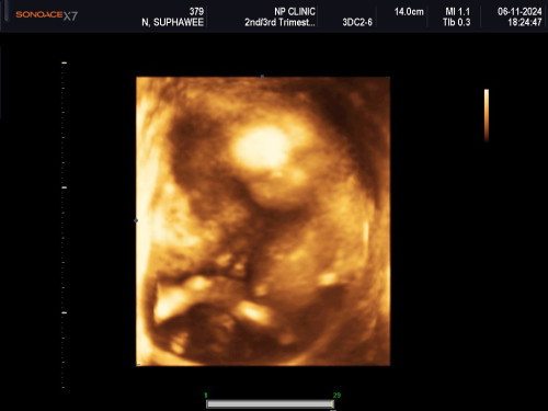 16week ++ ไปเจอมารอบนี้โตขึ้นเยอะเรย