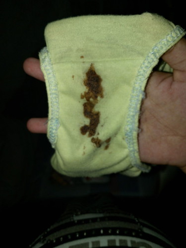 Dark brown discharge na may kunting abdominal pain @38weeks and 6 days pregnant