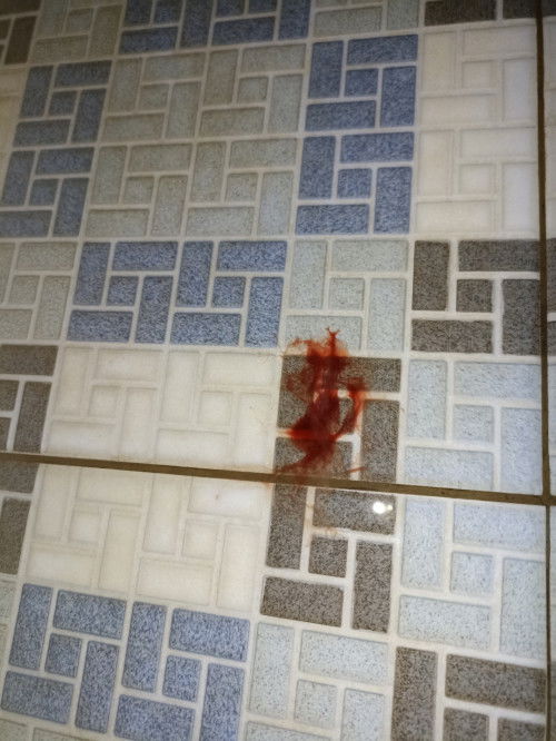 Brharap tak trjadi sesuatu