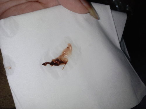 Flek coklat itu bahaya gak ya bunn