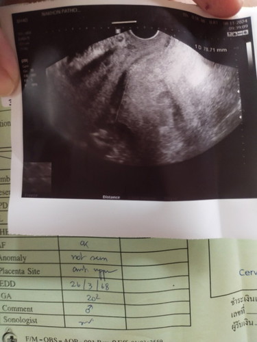 สอบถามเพื่อนๆค่ะ