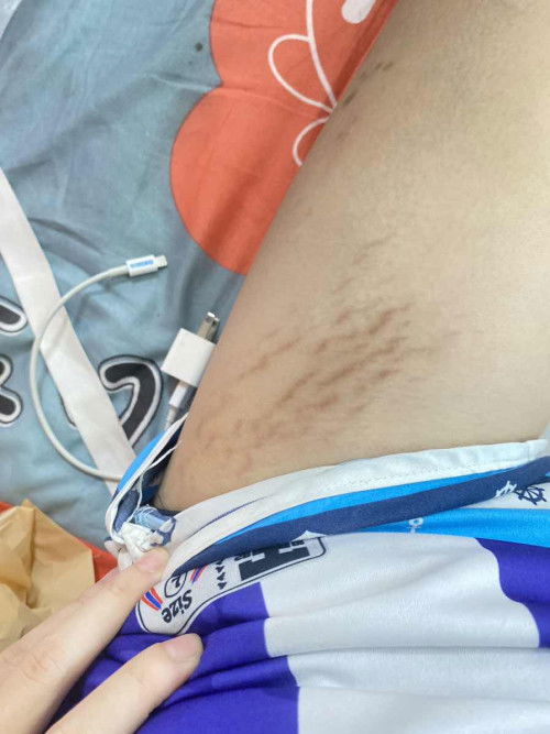 ใช้อะไรลอยแตกถึงหายบ้างคะ?😭😭