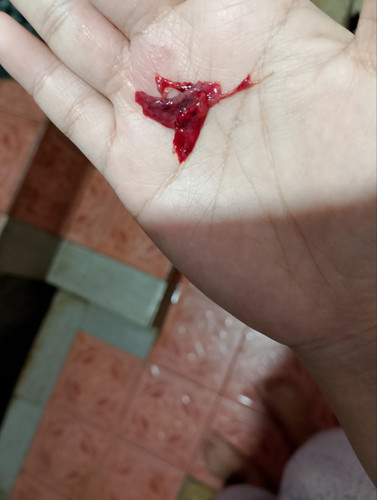 Nak tanya normal x period kluar macam ni