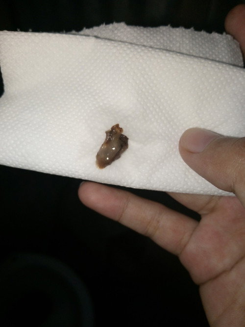 Mucus plug @38weeks and 6days