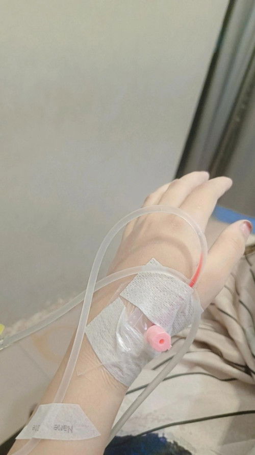 Ketuban rembes 33minggu