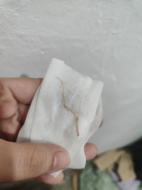 Light Brown Discharge after Pee