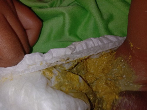 Tentang bab bayi umur 3 bulan lebih