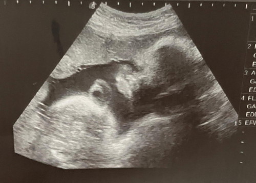36+6 weeks