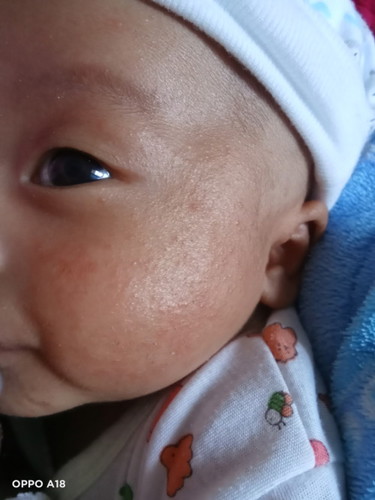 น้องมีพื่นแดงๆ