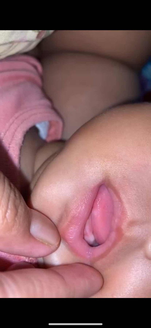 Tumbuh gigi