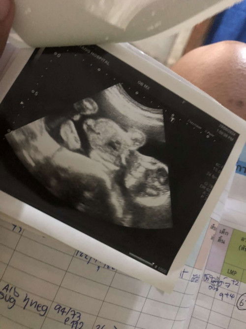 สอบถามหน่อย