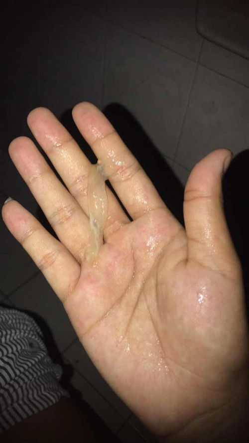 ตอนนี้มีมูกใส ตั้งแต่ตื่นเลยค่ะ ปวดอึเข้าห้องน้ำบ่อย