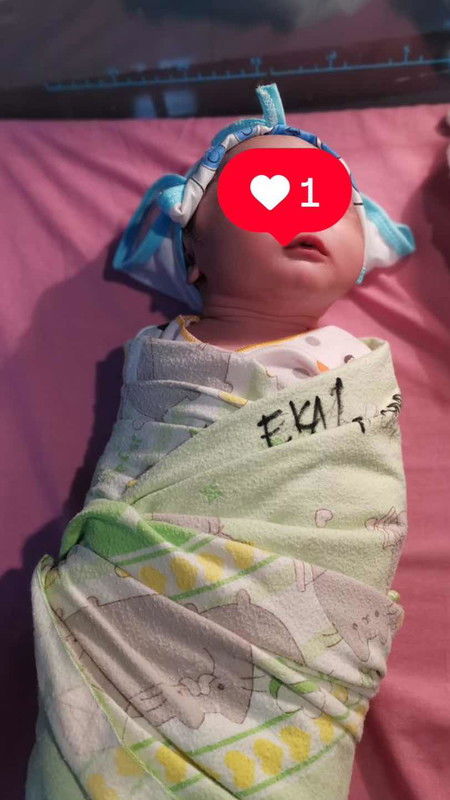 Induksi 3x hampir gagal