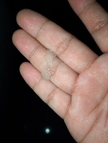 Mucus plug or normal discharge