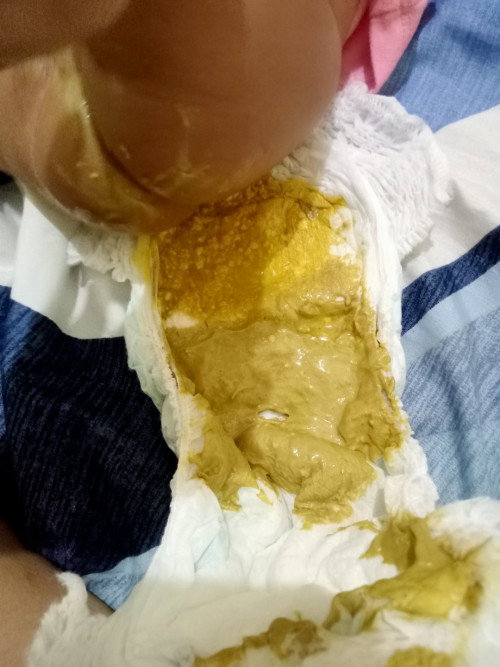 Bab bayi 2 macam yg satu kaya ada biji cabe nya