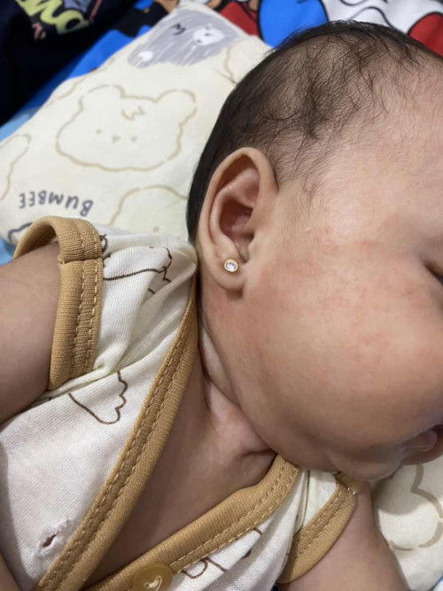 Cara agar kulit bayi mulus